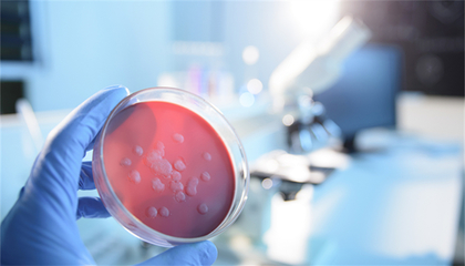 蘭州獸醫研究所布魯氏桿菌感染65人呈陽性,市疾控中心:已展開調查